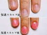 深爪＆爪噛みから「爪を守る！自爪育成の為」の保護スカルプ￥9500