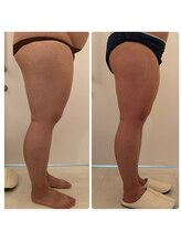 美人バスト 浜松店/【バストを残してダイエット★】