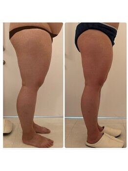 美人バスト 浜松店/【バストを残してダイエット★】