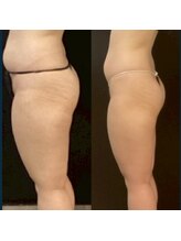 ウィンウィン 新山口店(Win Win)/肉割れも改善