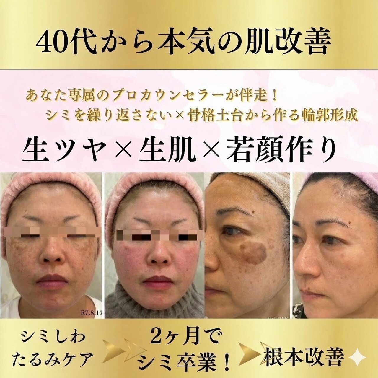 【人気No.1・初回限定】本気のシミしわたるみ根本肌改善★