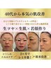 【人気No.1・初回限定】本気のシミしわたるみ根本肌改善★
