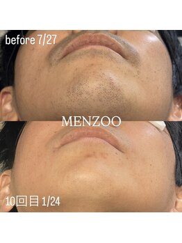 メンズー(MENZOO)/