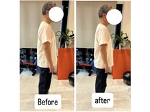 カワル整体 上通り院/巻き肩の緩和と胸の開き