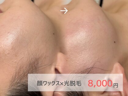 ピミル(PIMIL)の写真