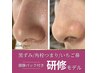 残り2枠【5名様限定】毛穴ごっそり研修モデル!!