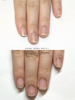 マリーロール 梅田店(Marie Laure)/自爪育成/深爪矯正/ネイルケア