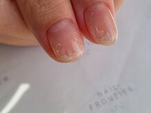 ネイルフロンティア 吉祥寺(NAIL FRONTIER)/繊細フラワーアート8980円～