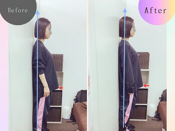 骨盤メディカル整体院 岡山大供院/施術前後の姿勢を、写真で確認☆