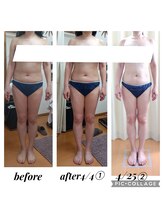 クリオネ(Clione)/スリム美姿勢メゾット