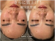 サロンドシー(SALON DE C)/韓国肌管理！ILLON