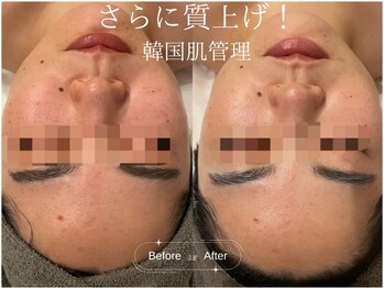 サロンドシー(SALON DE C)/韓国肌管理！ILLON