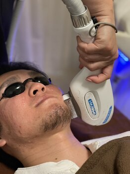 パールプラス(Pearl+)/メンズヒゲ脱毛☆