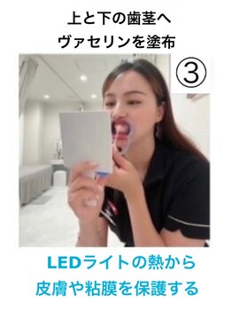 ホワイトニングショップ 今治店/ホワイトニング方法3