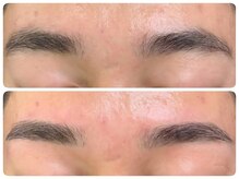 トータルビューティ ノイド(Noid)/メンズ美眉WAX脱毛