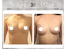 フェリス(Feliz)/【バストアップ/育乳/安城】