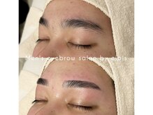 エルピス(elpis)/産毛を除去しスッキリと