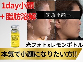 ハジチ(HAZICHI)の写真/【GW即効で小顔にしたい方】韓国発祥/世界中で話題のオーガニックで安心「レモンボトル×光フォト」で速感