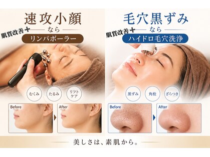 ワンブルーム(OneBloom)の写真