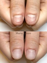 マリーロール 梅田店(Marie Laure)/自爪育成/深爪矯正/ネイルケア