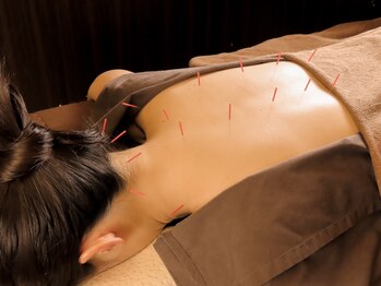 エイチスリー 表参道院/根強いコリに鍼灸コース!