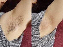 リコ バイ グラス(Rico by GRASS)/脇の下 Waxing