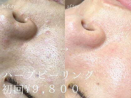 エーアール(ar)の写真