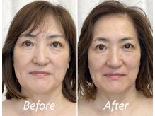 ドクターボディ 新宿店(Dr.Body)/【歪み/左右差/引締め　50代】