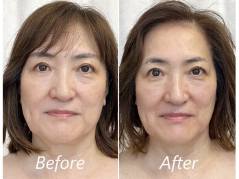 ドクターボディ 新宿店(Dr.Body)/【歪み/左右差/引締め 50代】