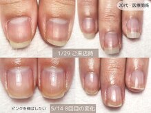 エヌプラス(Nplus)の雰囲気（ピンクの部分を伸ばしたい方、当サロンへおまかせください♪）