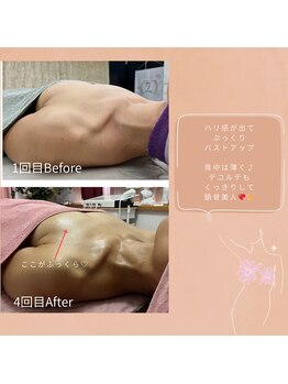 チュラ 大宮店(Chura)/【40代】バストアップ4回目@大宮