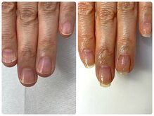 ピュールネイル(pur nail)の雰囲気（ネイルケアで地爪で過ごせられる縦長・強い爪に変化します）