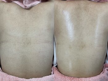 ソルシエール キレイ(ソルシエールkirei)/うなじ×背中