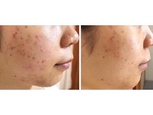 スリリアン 銀座/★お客さまビフォーアフター★