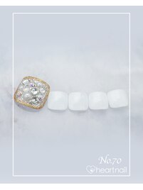 PG011280382