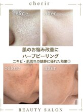 シェリール(cherir) 肌悩み 改善