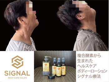 もりさわ治療院 与力町治療室 &nbsp;トサカ(TOSAKA)/三井シグナル療法