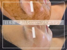 美肌専門サロン ベリッシア(BELLISIA)の雰囲気（レチノール・セラピール・ハーブピーリング・レモンボトル☆）