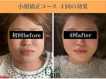 キュープ 表参道店(Qpu)/結果が出るから続けられる!