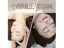 美リレアの雰囲気（食いしばり、エラ張り、ほうれい線、たるみに人気コース￥9980）