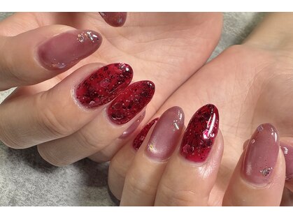 ブラウンネイル(brown nail)の写真