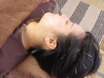 しおはりきゅう(SHIOはりきゅう)