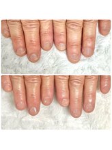 グラシナ 鳥丸店/深爪ブランド　gracina 