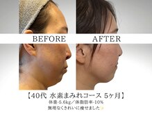 ヨサパーク ククナ 大塚(YOSA PARK kukuna)/痩身/ダイエット/よもぎ蒸し痩身