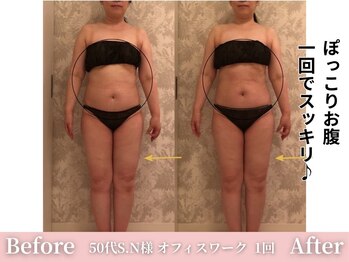 アメリイ 百合ヶ丘 新百合ヶ丘(Amerii)/【痩身】1回でお腹をスッキリ!