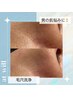 【男の肌悩みに！】毛穴洗浄×鎮静ケア◎黒ずみ毛穴すっきり♪¥6,500→¥5,500