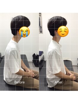ナオル整体 目黒院(NAORU整体)/before/after(目黒/整体)