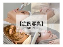 ルミライ(Lumirai)/たるみ改善/写真