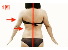 フォルティシモ ビューティ リラックス/【ぜい肉背中】痩身/燃焼超音波