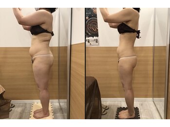 リッツ 草加店(Ritz)/【Before/After】痩身